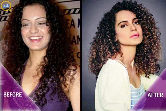 plastic surgery in bollywood