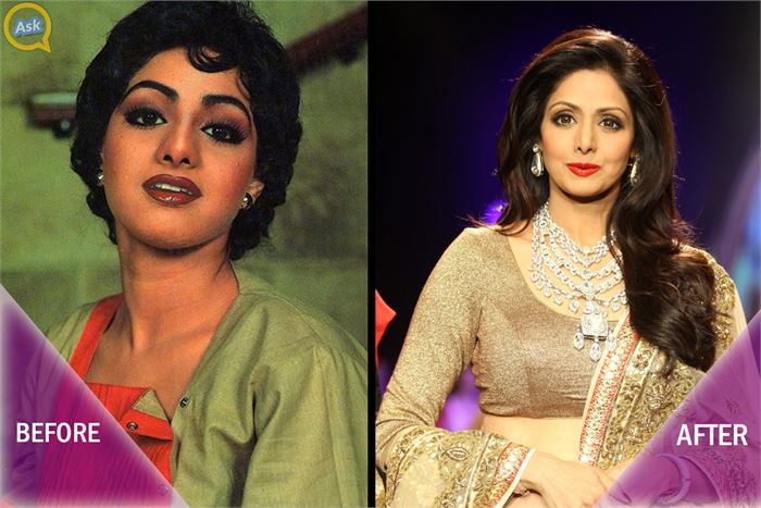 bollywood plastic surgeries