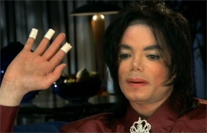 michael jackson skin