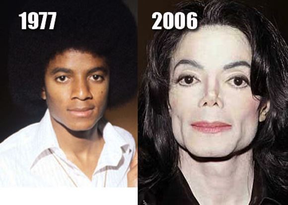 michael jackson before and after