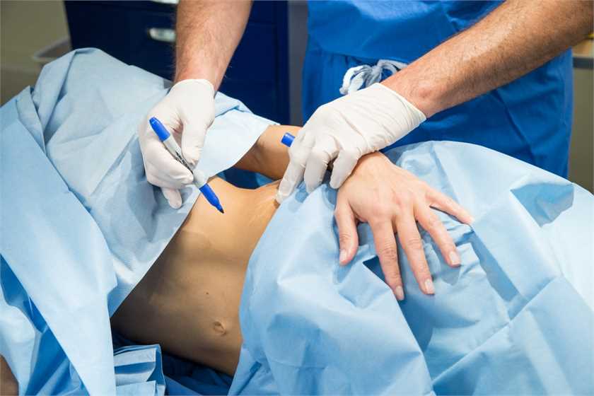 Learn what liposuction is all about  