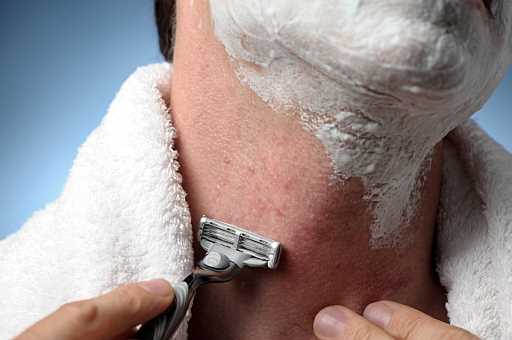 What precautions can be taken to prevent razor burns?