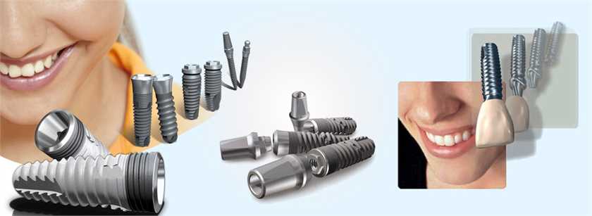 Why Dental Implants are Preferred Over Other Options for Missing Teeth?