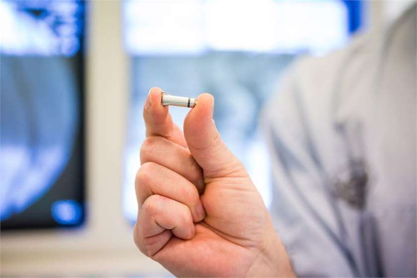 Medical Marvel: World's Smallest Leadless Pacemaker Successfully Implanted