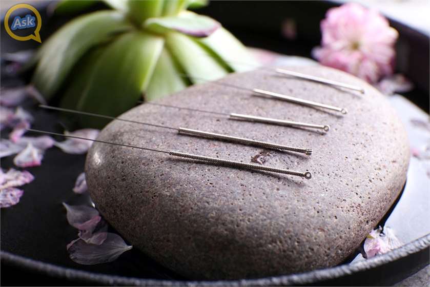 Acupuncture And Its Effectiveness In Weight Loss