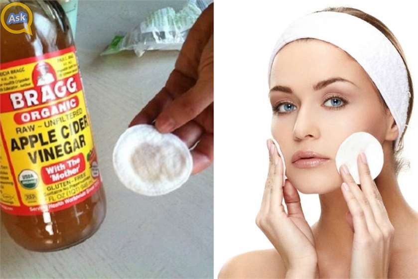 How does Apple Cider Vinegar help Remove Skin Tags?