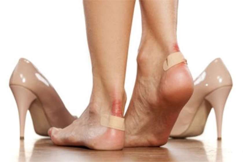 How to Treat Blisters? 