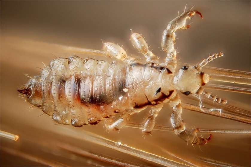 What does Head Lice look like? How to get Rid of it?